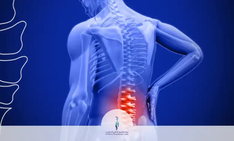ألم الظهر
