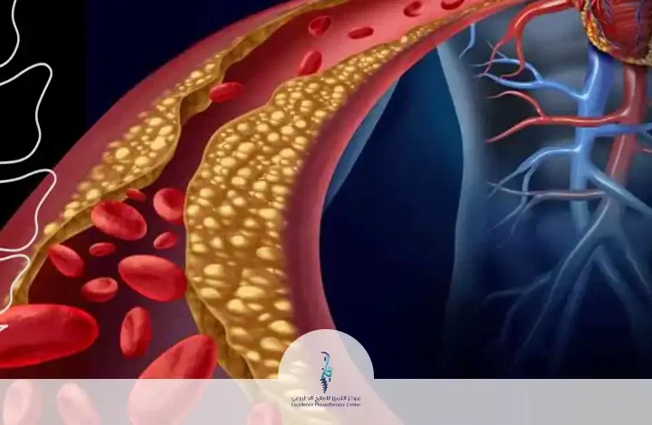 ارتفاع الكولسترول