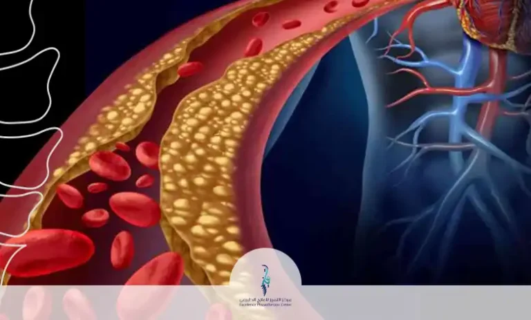 ارتفاع الكولسترول