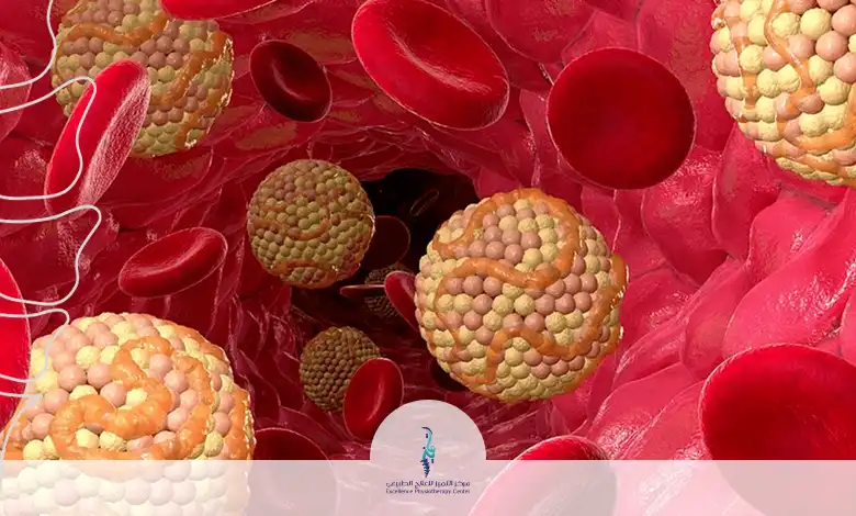 ارتفاع الكولسترول