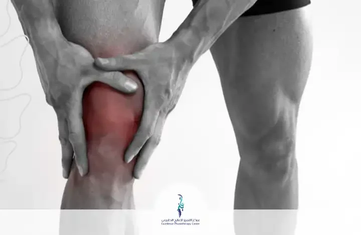 تمارين علاج انحراف صابونة الركبة