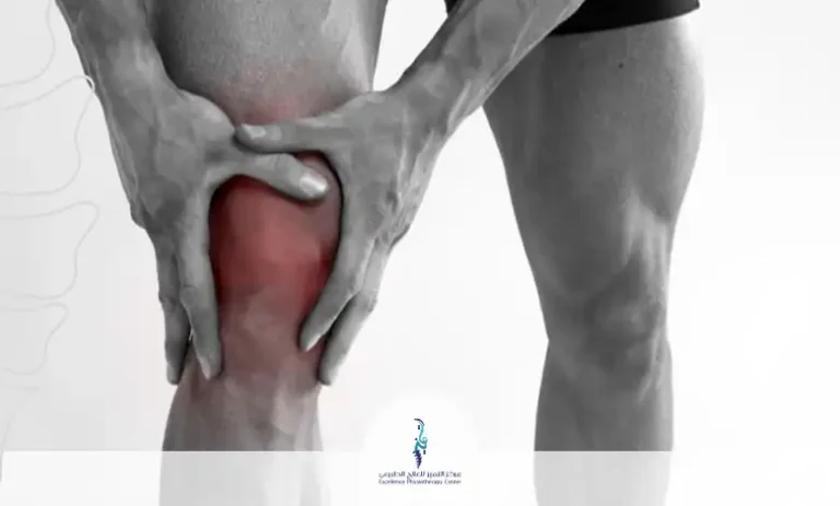 تمارين علاج انحراف صابونة الركبة