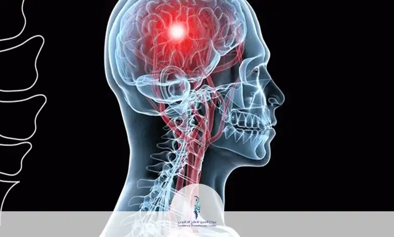 تمارين العلاج الطبيعي للجلطة الدماغية