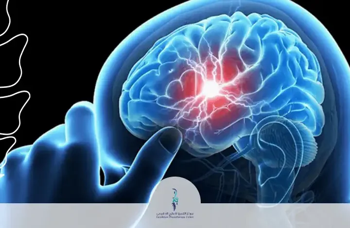 أنواع الآلام العصبية