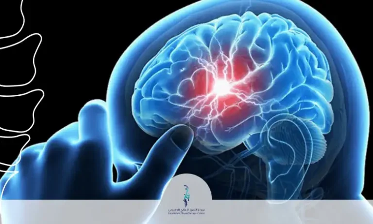أنواع الآلام العصبية