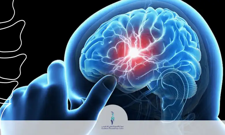 أنواع الآلام العصبية