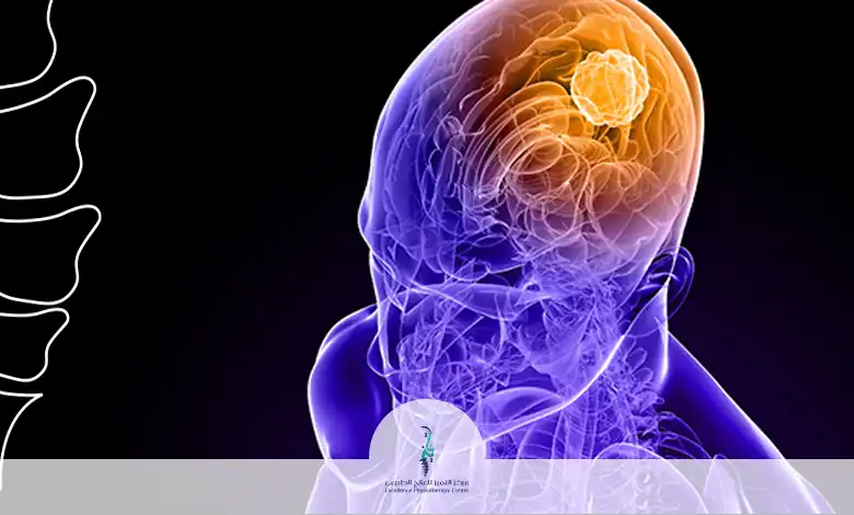 أنواع الآلام العصبية