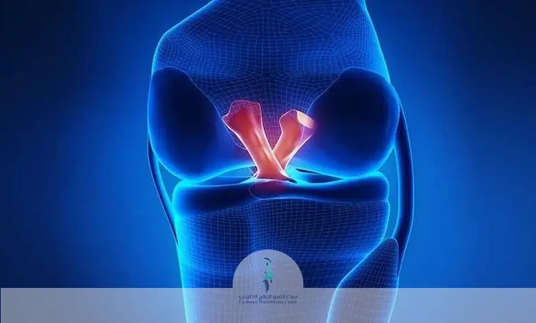 إصابة الرباط الصليبي الأمامي