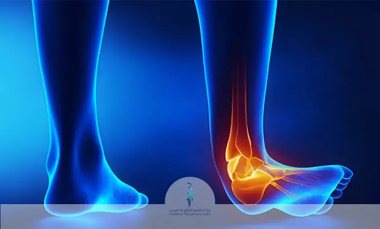 التواء الكاحل وتمزق الاربطة