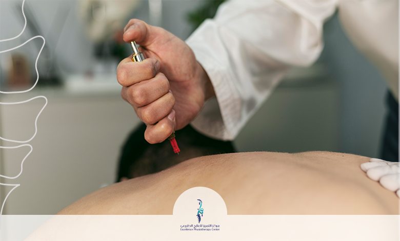 العلاج بالابر الصينية