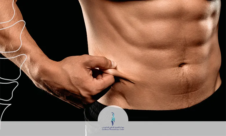 الانفصال العضلي في البطن