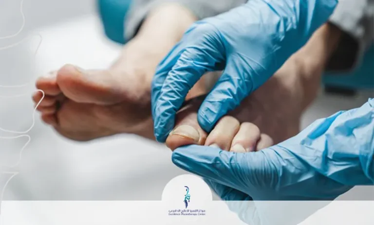 مسمار القدم والثالول