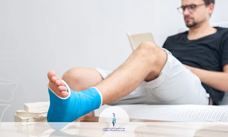 العلاج الطبيعي بعد كسور العظام