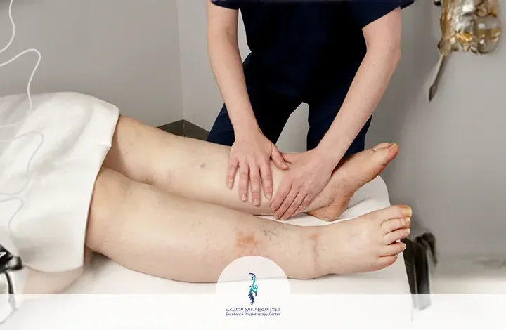 علاج الوذمة اللمفاوية بالأعشاب