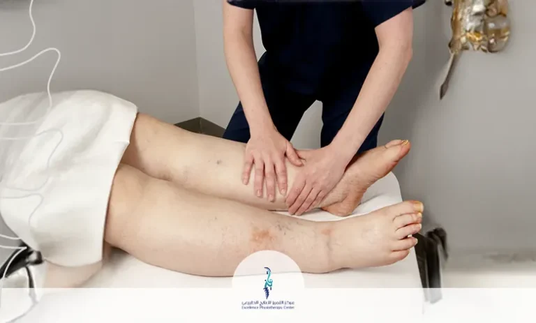 علاج الوذمة اللمفاوية بالأعشاب