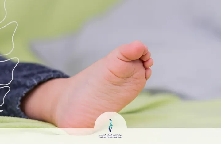 القدم المسطحة عند الأطفال