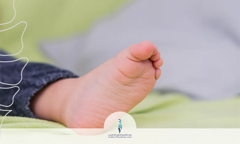 القدم المسطحة عند الأطفال