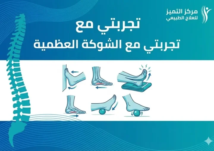 تجربتي مع الشوكة العظمية: مزايا علاج العظمة الشوكية بالعلاج الطبيعي