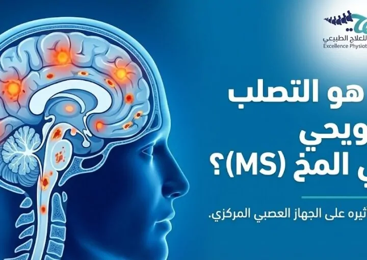 ما هو التصلب اللويحي في المخ (MS)