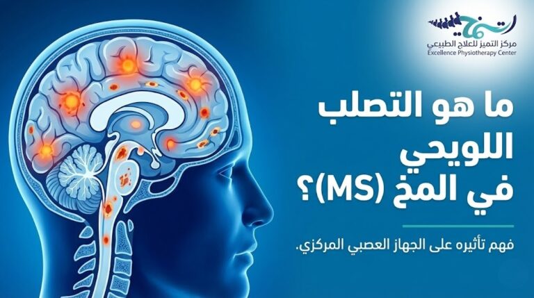 ما هو التصلب اللويحي في المخ (MS)