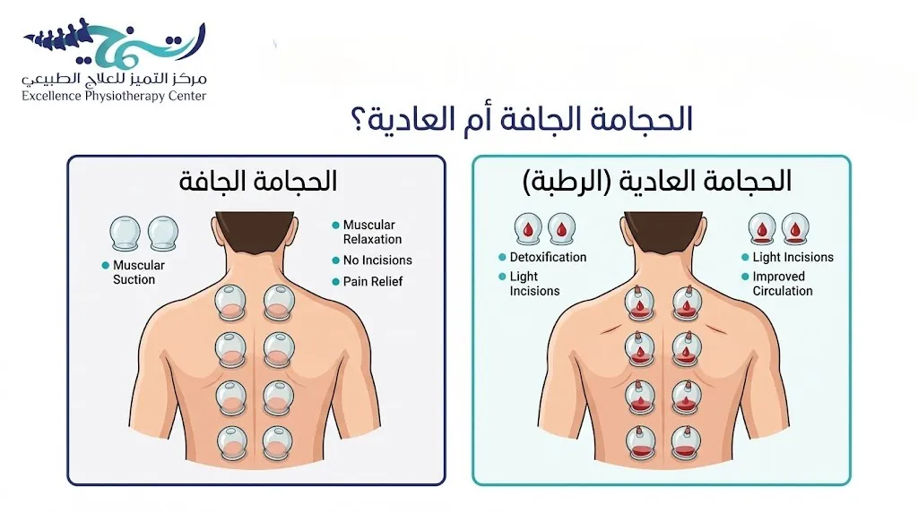 من أفضل الحجامة الجافة أم العادية؟ دليلك لاتخاذ القرار الصحيح 4 من أفضل الحجامة الجافة أم العادية؟