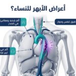 أعراض الأبهر للنساء: دليلك للتشخيص والعلاج