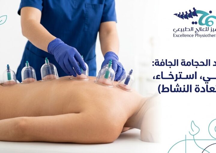 فوائد الحجامة الجافة