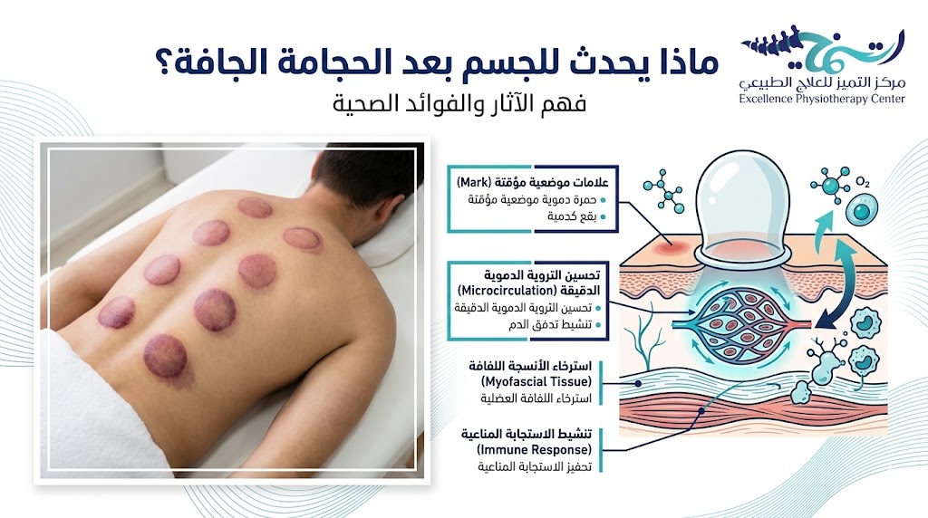 ماذا يحدث للجسم بعد الحجامة الجافة