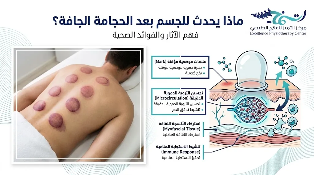 ماذا يحدث للجسم بعد الحجامة الجافة؟ دليلك الكامل للتغيرات والنصائح 2 ماذا يحدث للجسم بعد الحجامة الجافة