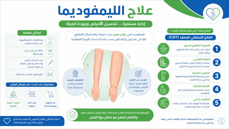 تجربتي مع علاج الليمفوديما