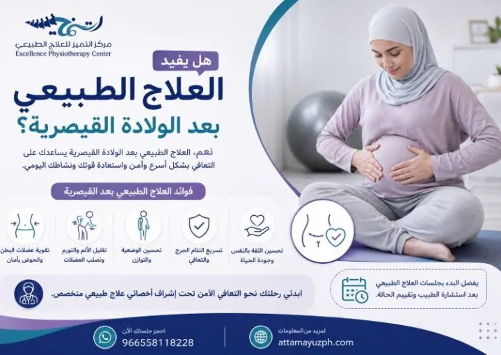 هل يفيد العلاج الطبيعي بعد الولادة القيصرية؟