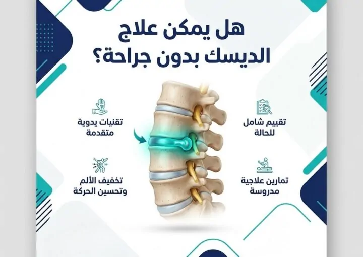 هل يمكن علاج الديسك بدون جراحة