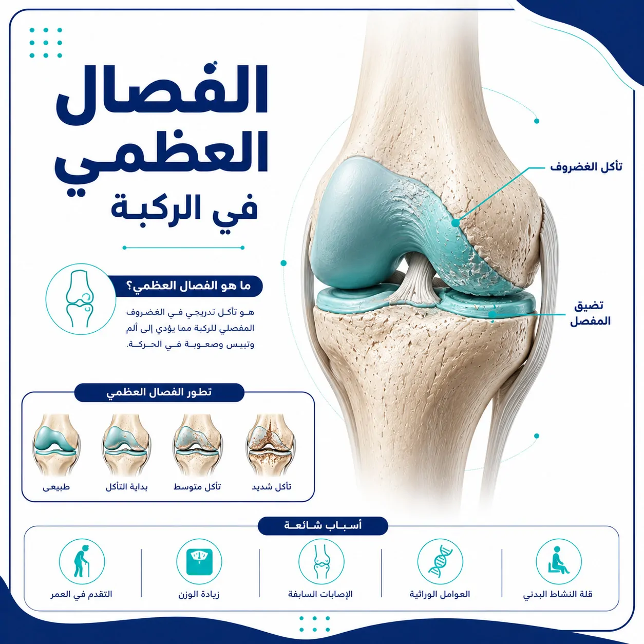 الفصال العظمي في الركبة