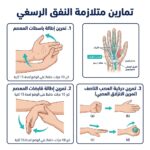 متلازمة النفق الرسغي تمارين