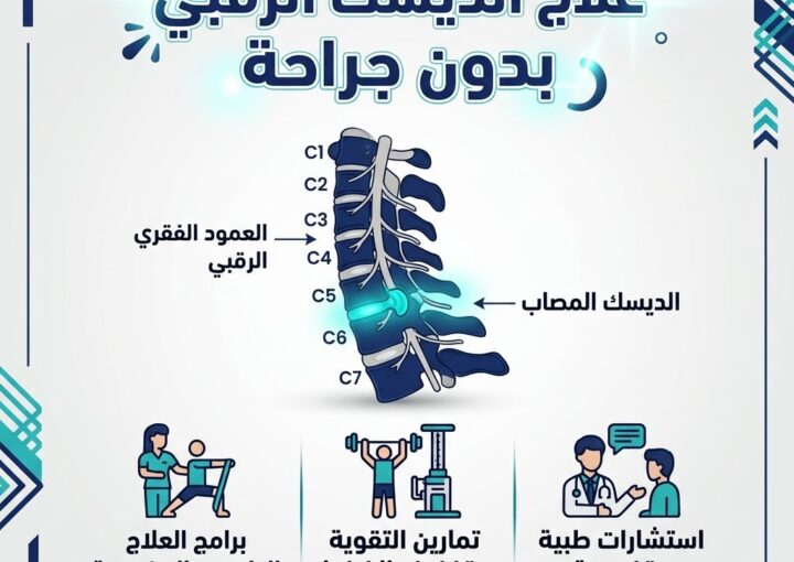 علاج الديسك الرقبي بدون جراحة