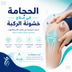 هل تفيد الحجامة في علاج خشونة الركبة؟
