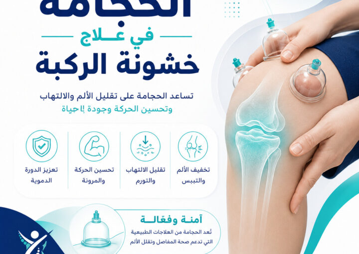 هل تفيد الحجامة في علاج خشونة الركبة؟