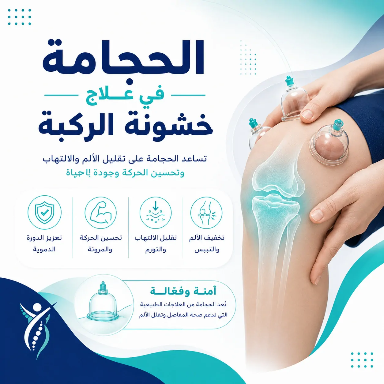 هل تفيد الحجامة في علاج خشونة الركبة؟ فوائدها وحدود فعاليتها 2 هل تفيد الحجامة في علاج خشونة الركبة؟