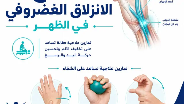 علاج الانزلاق الغضروفي في الظهر