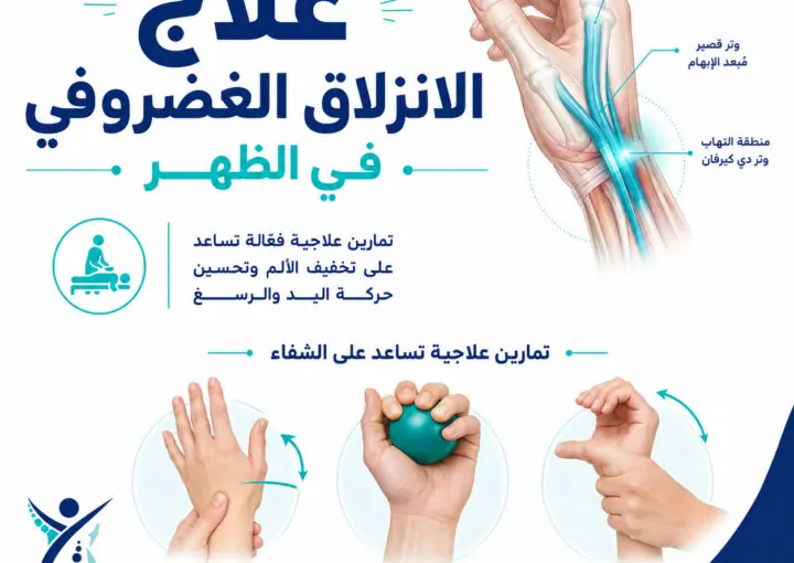علاج الانزلاق الغضروفي في الظهر