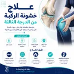 علاج خشونة الركبة من الدرجة الثالثة