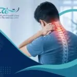 علاج الانزلاق الغضروفي في الرقبة: أسباب الحالة وأعراضها وأفضل خيارات العلاج الطبيعي 