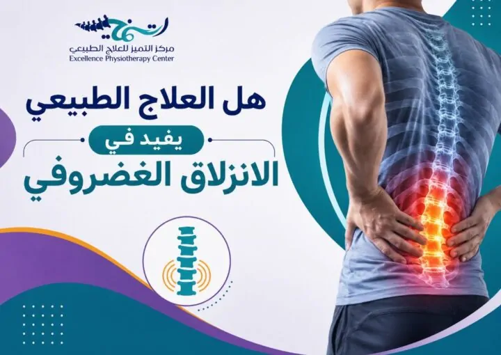 هل العلاج الطبيعي يفيد في الانزلاق الغضروفي