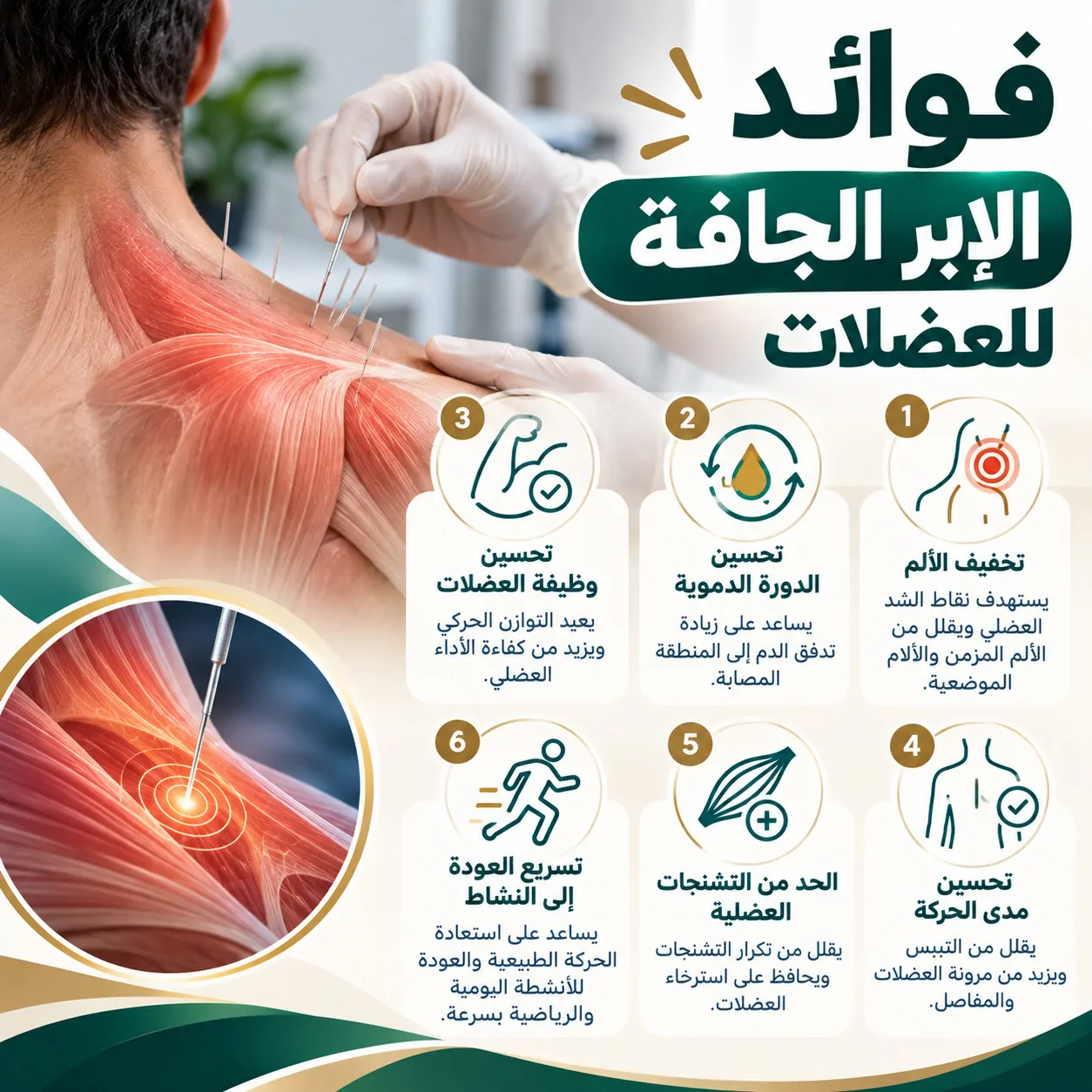 فوائد الإبر الجافة للعضلات