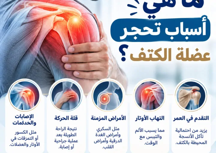 اكتشف ما هي أسباب تحجر عضلة الكتف للوقاية منها فوراً