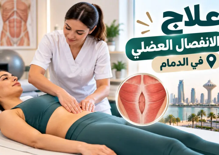 علاج الانفصال العضلي في الدمام