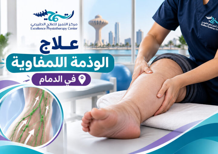 علاج الوذمة اللمفاوية في الدمام