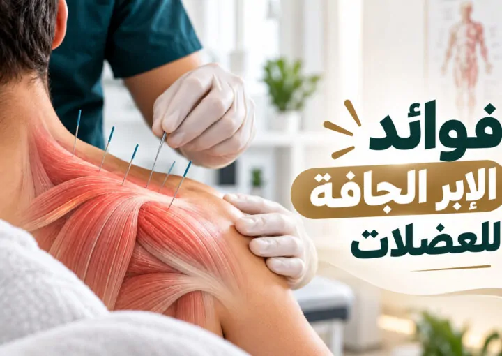 فوائد الإبر الجافة للعضلات