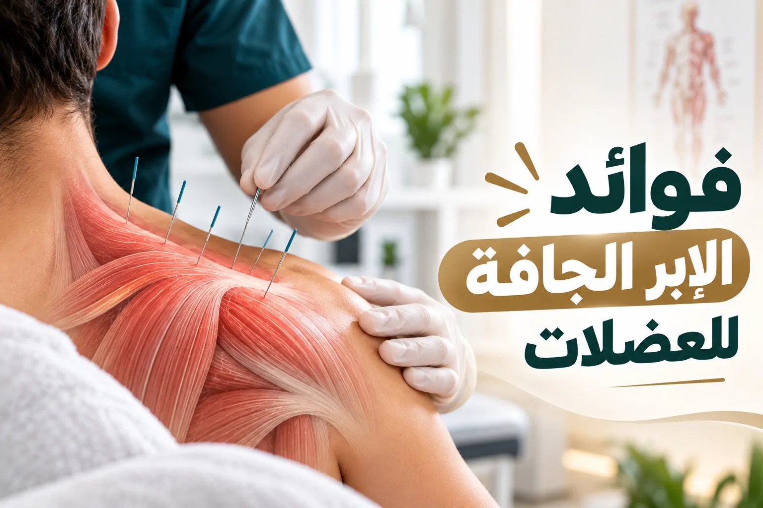 فوائد الإبر الجافة للعضلات
